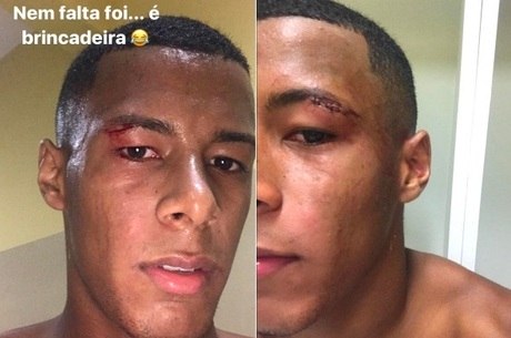 Supercílio de Arthur Gomes ficou bastante machucado
