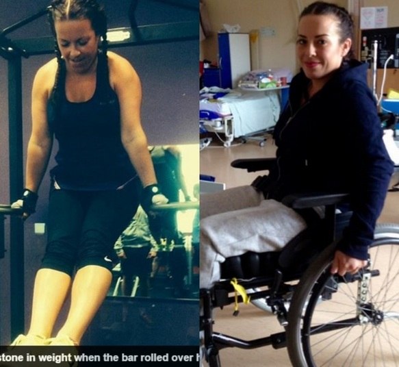 Uma mulher de 31 anos ficou paraplégica após fazer exercício de agachamento com peso na academia. Victoria Griffiths carregava 130 kg (o dobro do seu peso ccorporal) quando escorregou e caiu para a frente. Suas costas estalaram e 'dobraram ao meio'. As informações são do jornal Daily Mail