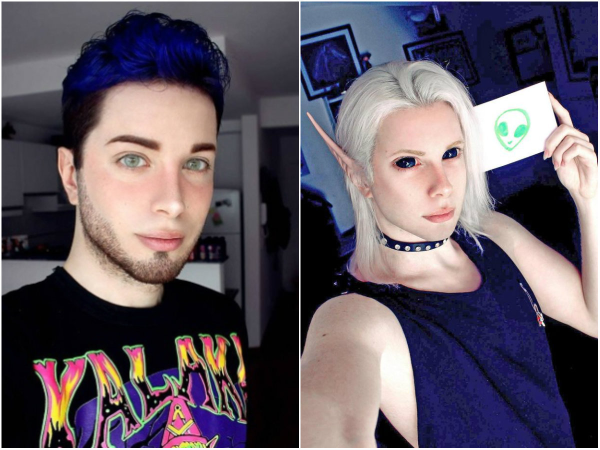 Argentino que sofria com bullying gasta R$ 100 mil em cirurgias para virar  um... Elfo! - Fotos - R7 Hora 7