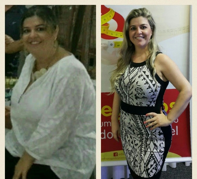 Mulher Perde Quase 30 Kg Em Tres Meses Em Metodo Que Reprograma Cerebro Fotos R7 Saude