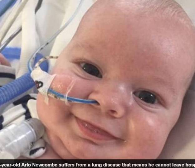 Arlo Newcombe, de apenas um ano, sofre de uma doença
pulmonar que o obriga a ficar permanentemente ligado a máquinas e confinado em
um canto de quarto de hospital. Ele comemorou o primeiro aniversário nesta
semana, cercado por fios e tubos, em vez de ficar em casa com a família. Segundo o
pai do menino, Arlo sempre está sorrindo, mesmo com seu futuro incerto. As informações
são jornal Daily Mail