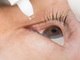 Secreção nos olhos, dor, vermelhidão e desconforto persistentes. Os sintomas são clássicos e indicam a presença da conjuntivite — uma das doenças oculares mais diagnosticadas nos meses frios do ano. De acordo com Gustavo Takahashi, oftalmologista do Complexo Hospitalar Edmundo Vasconcelos, de São Paulo, a conjuntivite é uma inflamação da conjuntiva — que é a parte mais externa do olho. As causas do quadro podem ser várias. Leia mais!