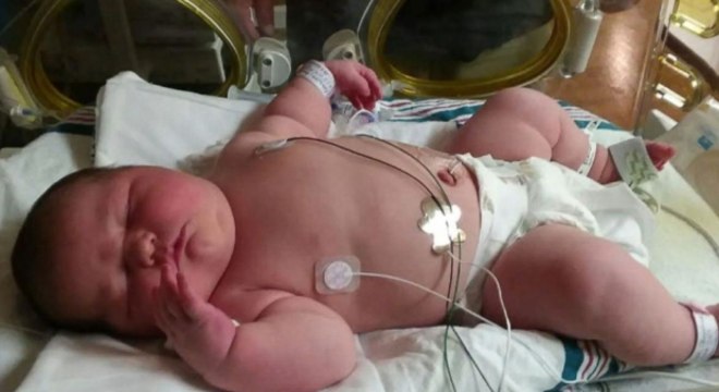 Americana Da A Luz Bebe Gigante De 6 Kg Noticias R7 Hora 7