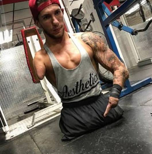 Nick Santonastasso, de 21 anos, nasceu com doença genética rara, conhecida como síndrome de Hanhart, que afeta o crescimento de membros. A taxa de sobrevivência é de apenas 30%