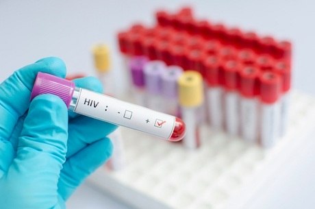 Nova mutação do HIV o tornou mais resistente a remédios