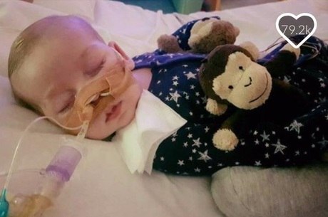 Charlie Gard, de 11 meses, sofria de uma condição rara