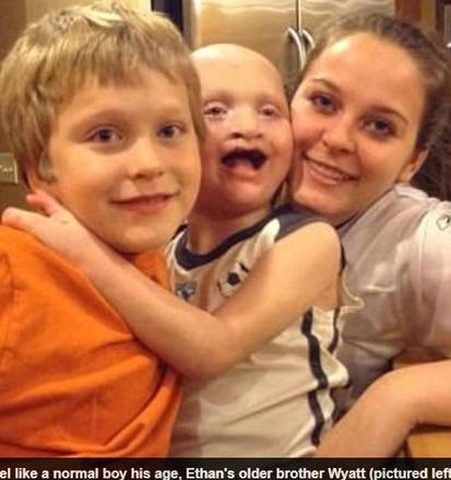 O
menino também precisa usar dentaduras. Aos nove anos, Ethan já passou por 29
cirurgias diferentes. O último procedimento foi realizado nos olhos porque ele
corria o risco de ficar cego. Antes da cirurgia, ele estava totalmente cedo do
olho direito e havia perdido 55% da visão do olho esquerdo