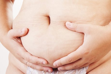 Após a gravidez, os músculos abdominais podem ficar estirados, enfraquecidos e separados