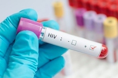 Descobertas maneiras de tirar HIV do esconderijo
