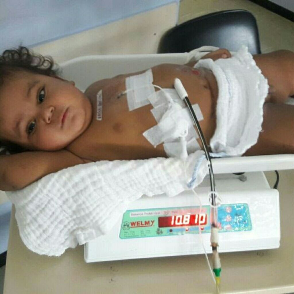 EUA: bebê brasileira com síndrome rara consegue transplante