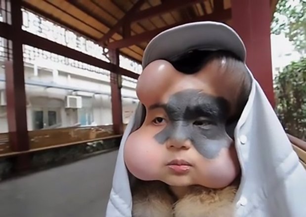 Resultado de imagem para Chinesa passa por tratamento inusitado para escapar da morte