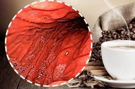 Descubra o que pode acontecer com seu corpo se você tomar café de estômago vazio
