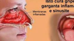 Este é o melhor remédio caseiro para curar gripe, sinusite e  inflamações na garganta!