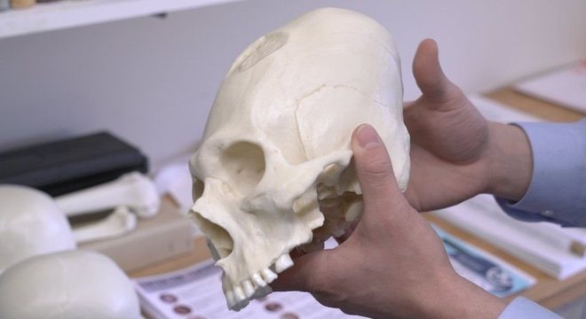 A forma longa e estreita da cabeça era uma característica distintiva do collaguas, mas ao longo do tempo se espalhou por todo o Vale do Colca