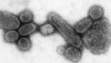 Pandemia da gripe espanhola teve variantes como ocorre com covid-19