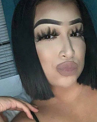 Neste caso, não se sabe o que ficou pior: os cílios exagerados ou o contorno da boca que extrapolou até os limites do preenchimento labial 