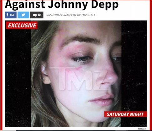 A atriz chegou a divulgar fotografia em que ela estava com aparentes hematomas, que seriam resultado das agressões físicas do ator. Depp diz que ela fingiu. 