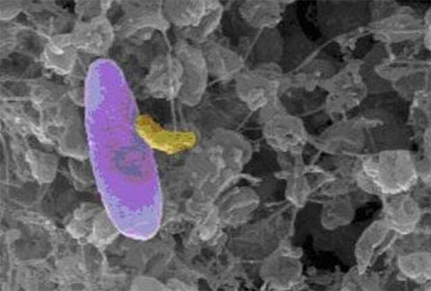 A bactéria Micavibrio aeruginosavorus recebe a alcunha de menor vampiro do mundo, mas é um título positivo. Isso porque ela se alimenta de outras bactérias. 