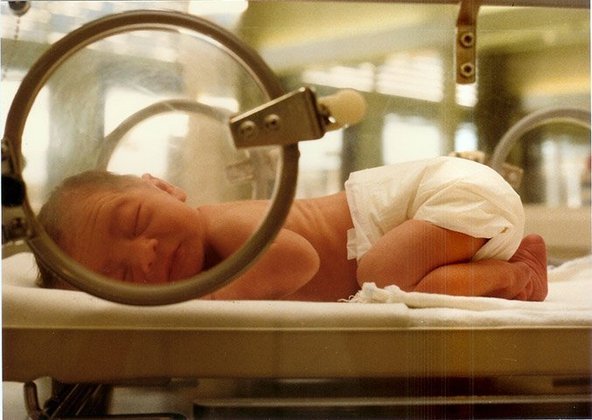 A prematuridade pode ser espontânea (quando, de repente, a mulher entra em trabalho de parto) ou induzida (quando o obstetra opta por antecipar o parto por risco à vida da mãe ou do bebê). 