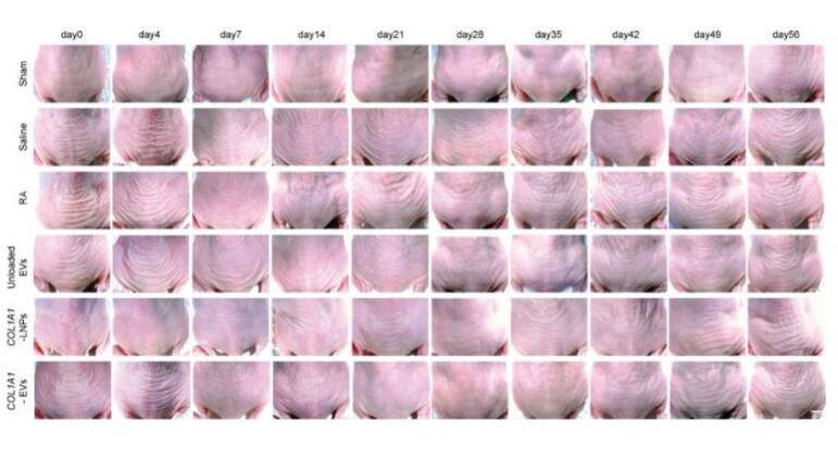 Ratos usados na pesquisa tiveram as rugas na pele amenizadas após o uso de adesivo de mRNA