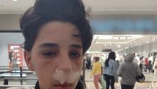 Irmã do adolescente que teve nariz quebrado por segurança em SP cobra justiça: "Nada justifica"