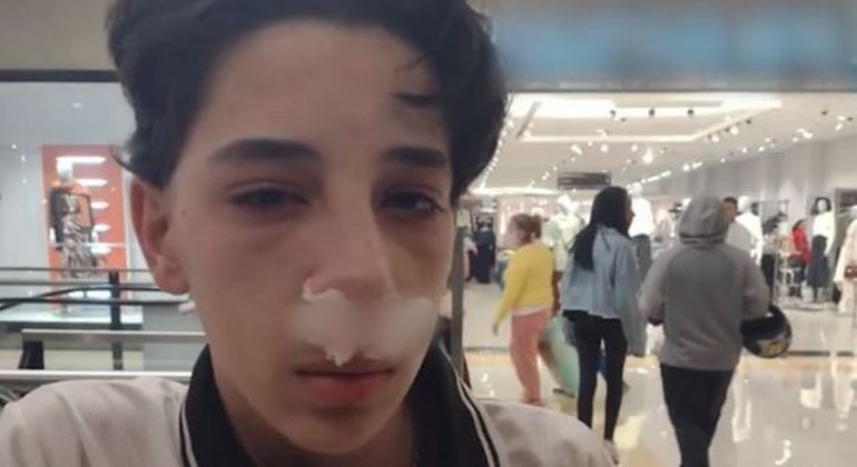 João Victor vai passar por cirurgia após ter o nariz quebrado por segurança de shopping