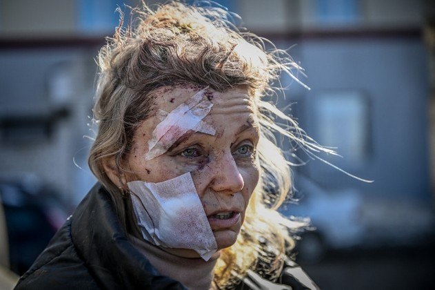 Influenciadora de beleza relata fuga da Guerra na Ucrânia