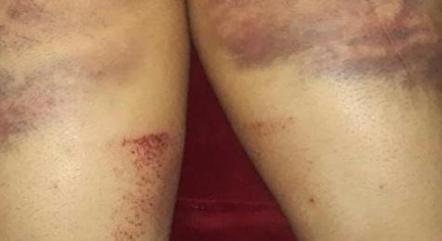 Policiais teriam sido agredidos no treinamento