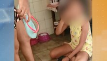 Polícia indicia mãe e madrinha suspeitas de torturar criança 