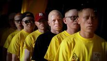 Assassinatos de albinos cresceram na pandemia, revela fonte da ONU 
