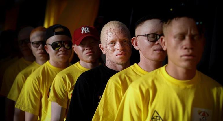 Maioria dos albinos mortos na pandemia foram crianças, afirma especialista da ONU