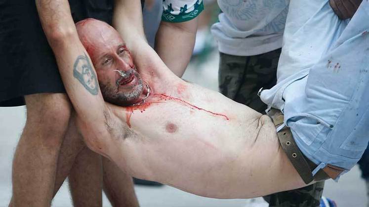 Além do torcedor na foto, vários outros ficaram gravemente feridos. Imagens de vários membros da organizada do Palmeiras batendo em torcedores comuns.