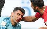 Alireza Beiranvand, goleiro do Irã, fica com o nariz sangrando após choque contra jogador da Inglaterra