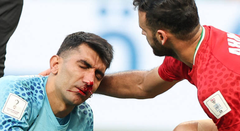 Alireza Beiranvand, goleiro do Irã, fica com o nariz sangrando após choque com companheiro
