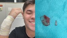 Influenciador Álvaro passa por cirurgia para tirar cacos de vidro do braço após se cortar em taça