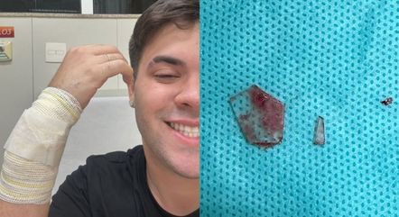 Álvaro passa por cirurgia para tirar cacos de vidro do braço