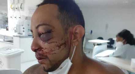 Gerson vai passar por cirurgia após ser agredido
