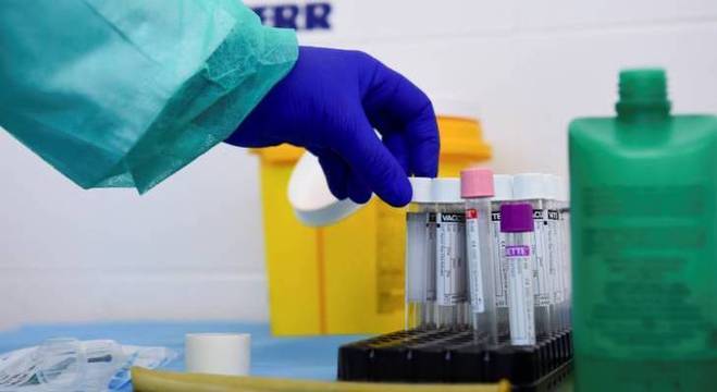 Amostras de sangue colhidas de trabalhadores para testes sorológicos na empresa Liebherr, na Itália