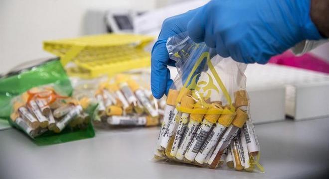 Amostras da pesquisa sobre por que a covid-19 causa inflamação em crianças