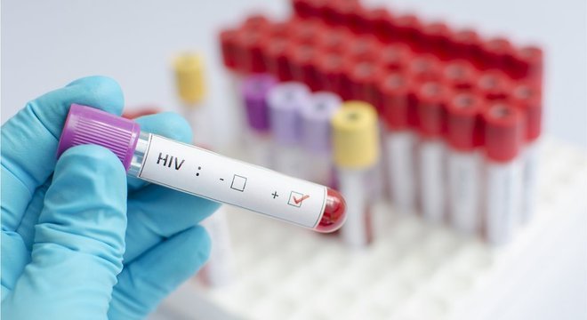 Número de novos casos de HIV vêm caindo lentamente na última década