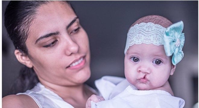 Ana Clara, uma das crianças atendidas pela Operação Sorriso