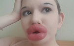 A búlgara Andrea Ivanova tem apenas 23 anos e tem como objetivo ter os maiores lábios do mundo. Ela já tem essa boca gigantesca e quer fazer mais intervenções cirúrgicas para aumentá-la — ainda que os médicos digam que isso pode ser um sério risco para a vida dela