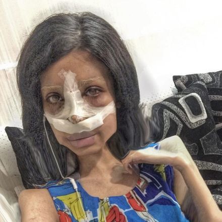 A mais recente é uma intervenção no nariz, que aparentemente é para deixá-la ainda mais parecida com a estrela de HollywoodVale o clique: Sexagenária é hospitalizada após confundir wasabi com abacate