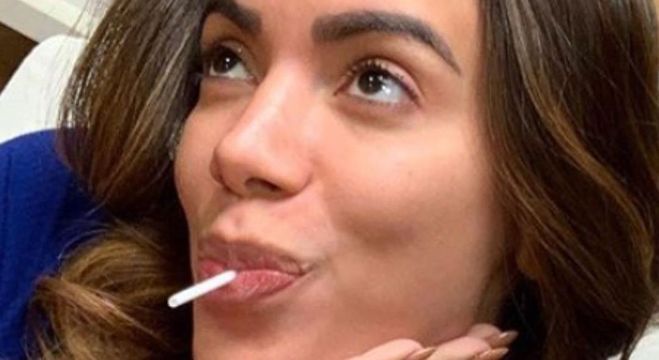 Para entrar na dieta, Anitta conta com a ajuda de pirulitos com ativos naturais 