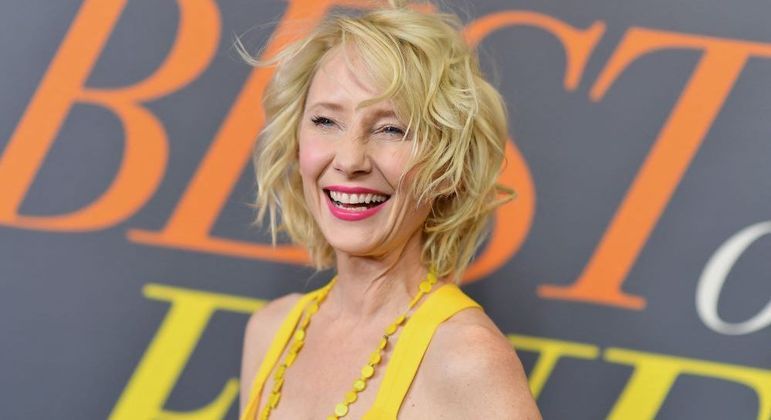 Anne Heche respira com a ajuda de aparelhos