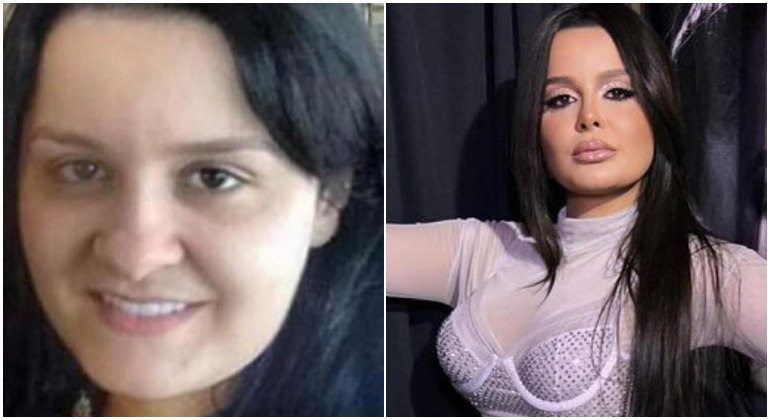 Antes e depois de Maraisa choca web