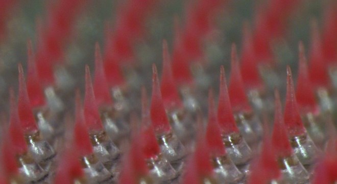 Imagem de microsc&oacute;pio mostra microagulhas de menos de 1 mil&iacute;metro
