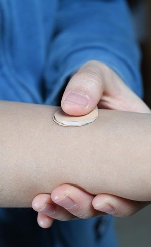 Adesivo cut&acirc;neo anticonceptivo de microagulhas se aplica &agrave; pele