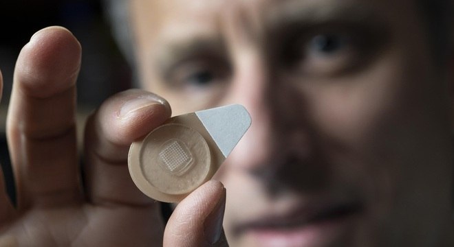 Pesquisador mostra dispositivo com anticoncepcional para ser aplicado na pele