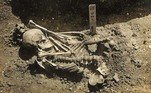 Um esqueleto encontrado no Japão também sofreu de modo similar. Mas nada de golpes, e sim um ataque de tubarão. Na verdade, o mais antigo registrado, com 3.000 anos. Contamos tudo em detalhes